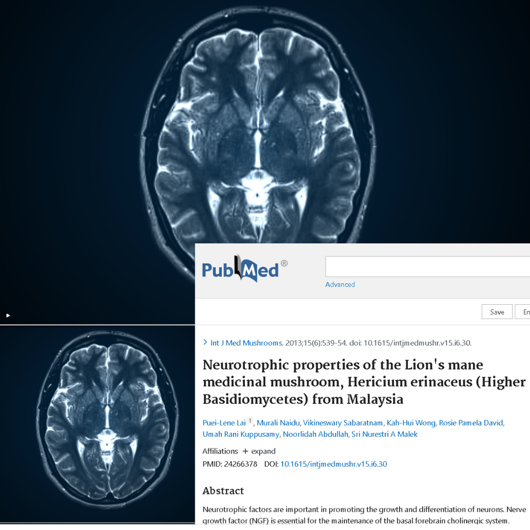Atividades neurotróficas, promoção do crescimento e diferenciação dos neurônios. O fator de crescimento nervoso (NGF)
